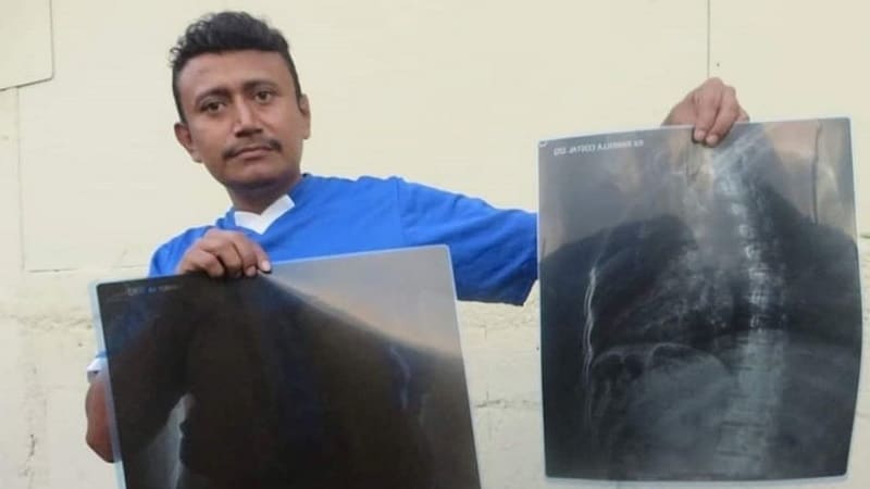 Preso Político Nicaragua