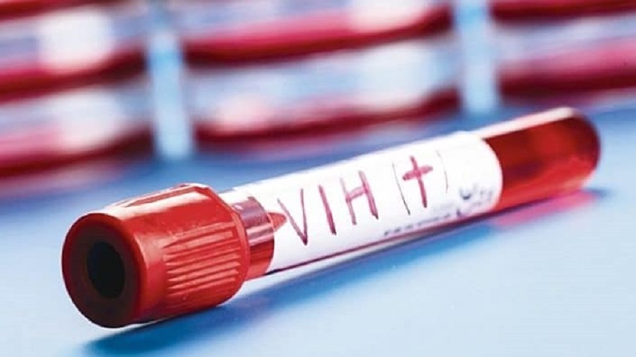 En 2022 Nicaragua ha detectado 932 casos de VIH-Sida
