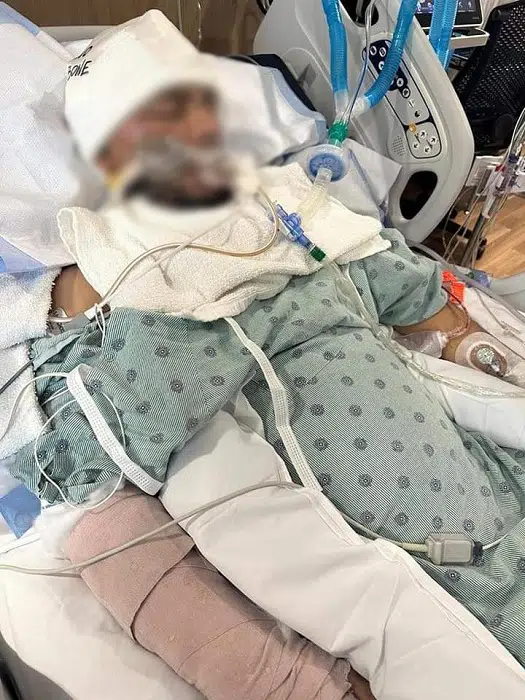 Familia de Marvin Guzmán Sequeira de 31 años de edad, espera que ocurra un milagro para que pueda salir del estado de coma en que se encuentra