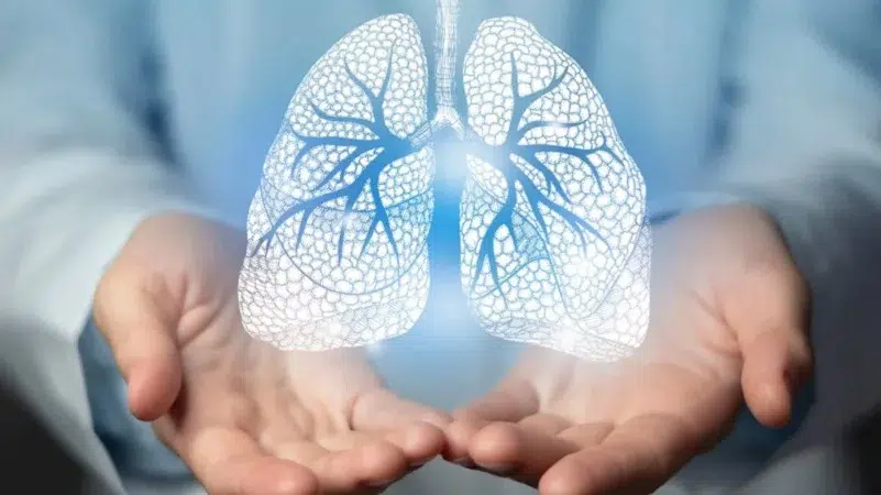 Médicos de Camoapa llaman a cuidarse de las enfermedades respiratorias