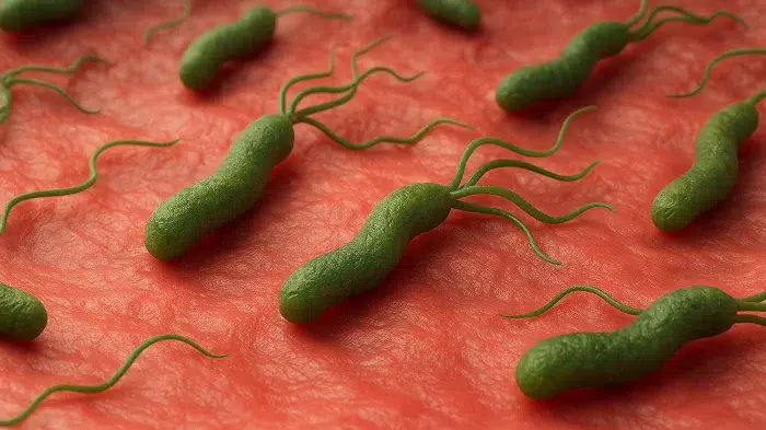 Helicobacter Pylori la bacteria responsable del 76 por ciento de los futuros casos de cáncer gástrico